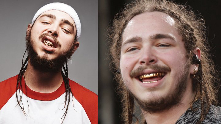 Post Malone Net Worth How Does the American Rapper Wealth Compare Today?